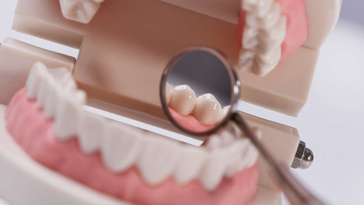 Medidas ideales de los dientes
