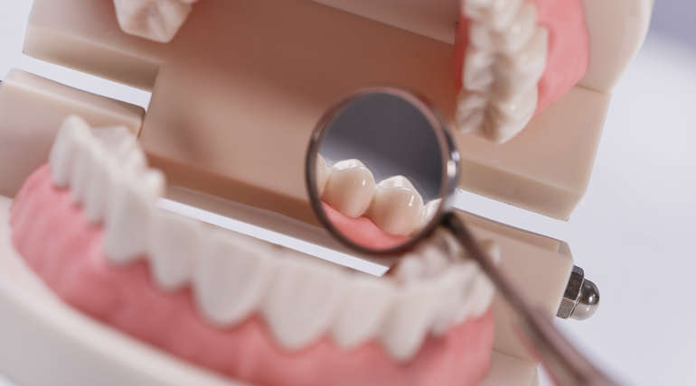 Medidas ideales de los dientes