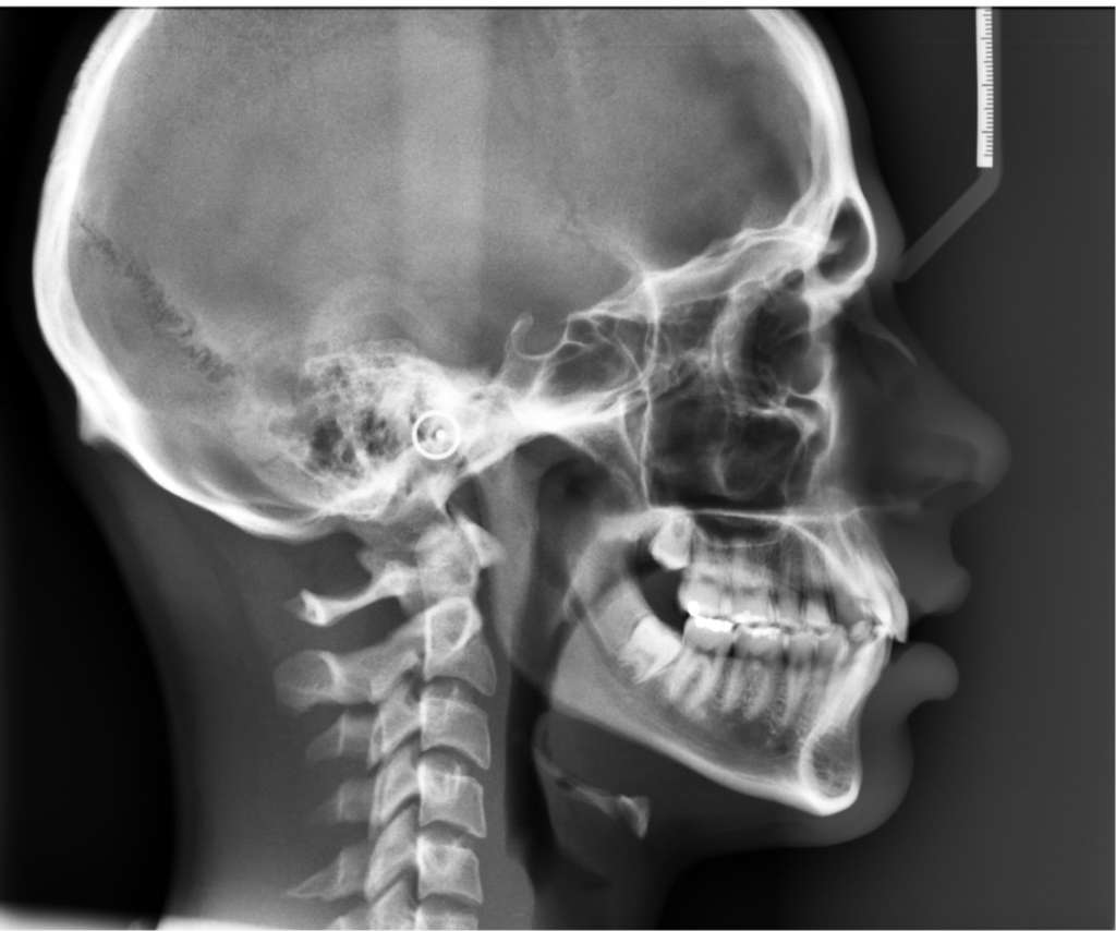 estudio-ortodoncia