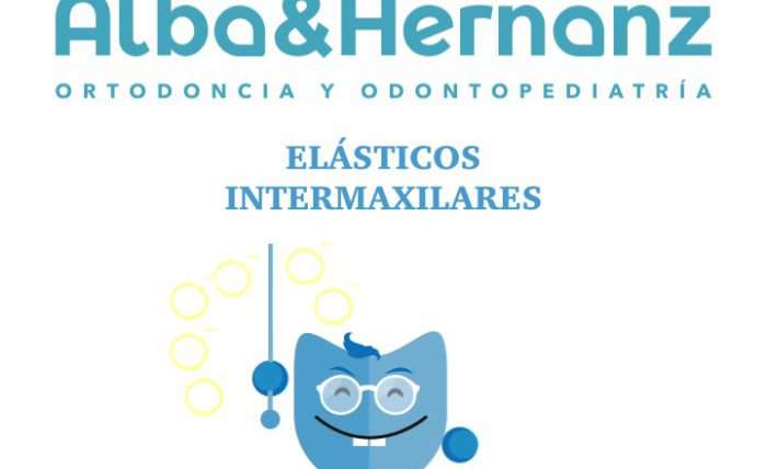Los elásticos intermaxilares en Ortodoncia