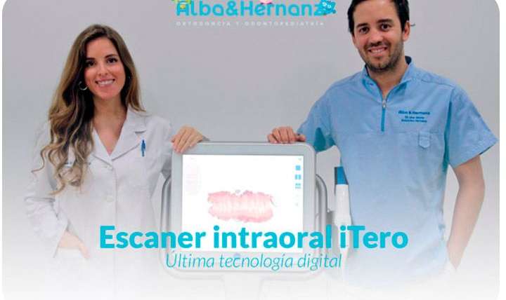 Nuevo escáner intraoral digital iTero