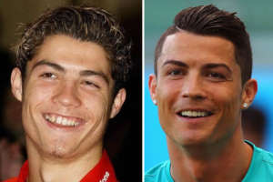 cristiano ronaldo cambio de cara con ortodoncia