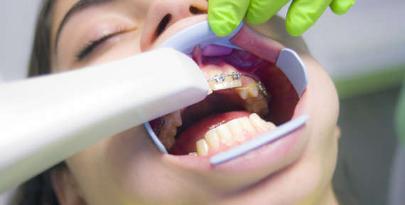 Luxación Dental