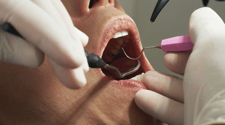 Enfermedades dentales mas comunes