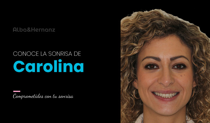 Carolina, 40 años, Invisalign
