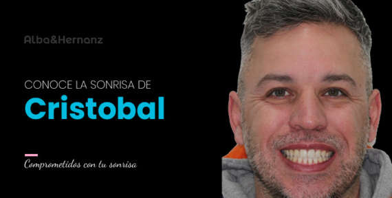 Cristobal, 40 años, Brackets 3m clarity ultra