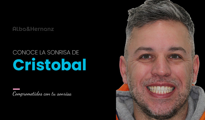 Cristobal, 40 años, Brackets 3m clarity ultra