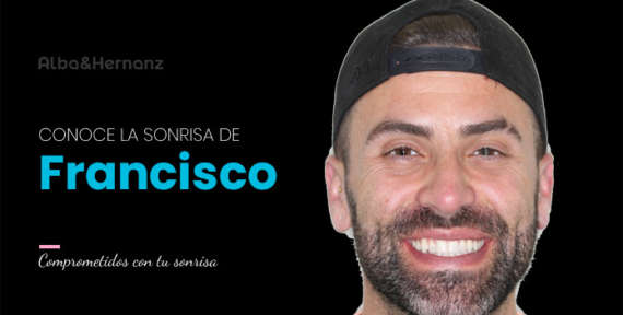 Francisco, 34 años, Brackets de oro