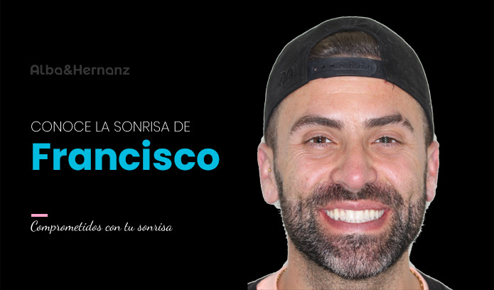 Francisco, 34 años, Brackets de oro