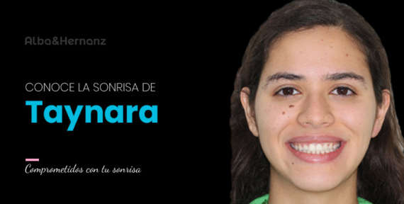 Taynara, 22 años, Brackets metálicos damon