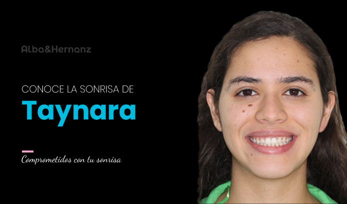 Taynara, 22 años, Brackets metálicos damon