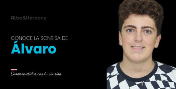 Alvaro, 17 años, Brackets de autoligado damon