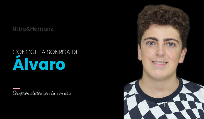 Alvaro, 17 años, Brackets de autoligado damon