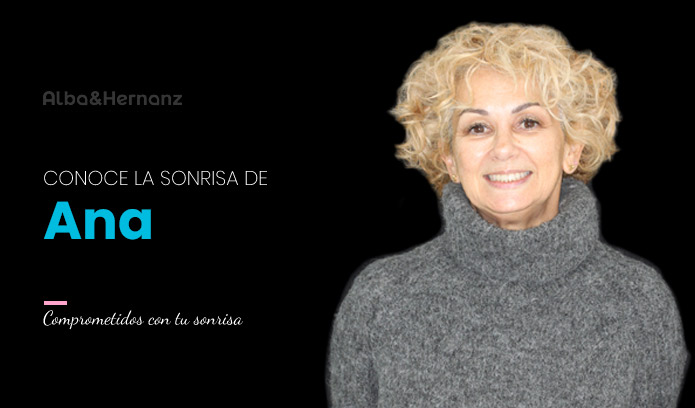 Ana, 57 años, Brackets de autoligado 3m Clarity