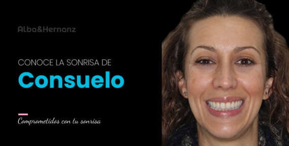 Consuelo, 42 años, Brackets 3m Clarity Ultra
