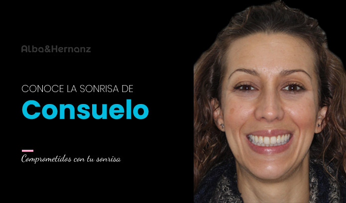 Consuelo, 42 años, Brackets 3m Clarity Ultra