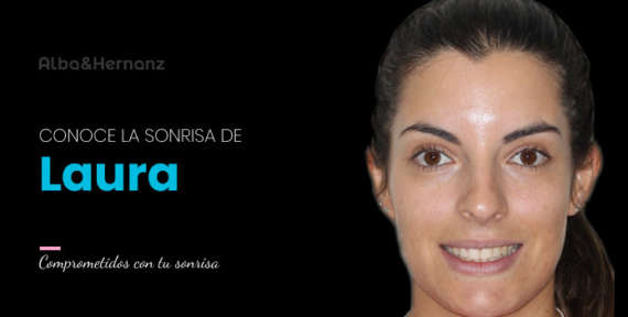 Laura, 31 años, Brackets de Zafiro