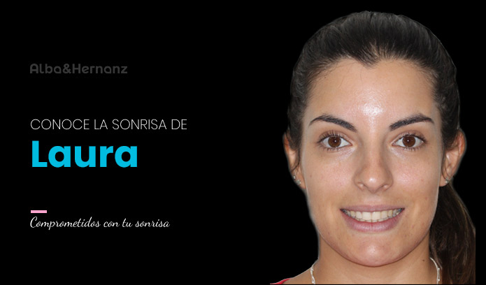 Laura, 31 años, Brackets de Zafiro