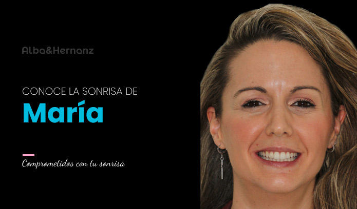 Maria, 34 años, Invisalign