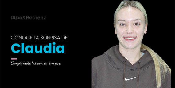 Claudia, 22 años, Brackets de Autoligado Damon