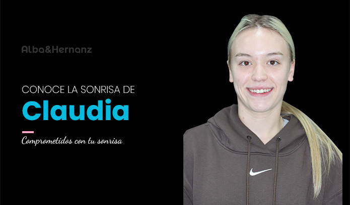 Claudia, 22 años, Brackets de Autoligado Damon