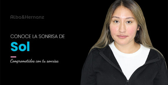 Sol, 28 años, Brackets de Autoligado Damon