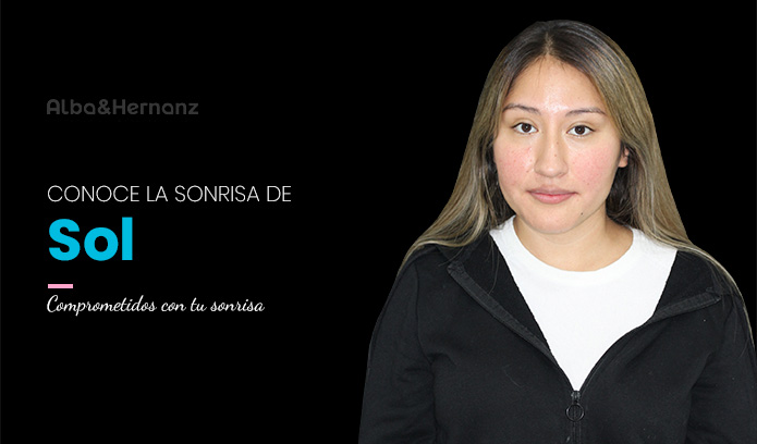 Sol, 28 años, Brackets de Autoligado Damon