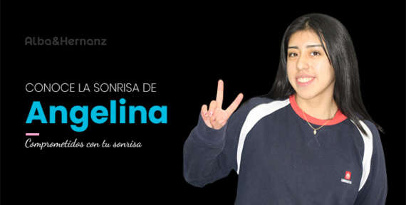 Angelina, 18 años, Brackets metálicos de Autoligado
