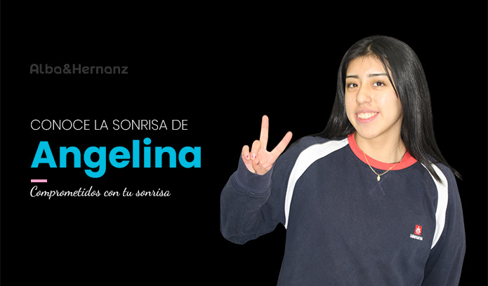 Angelina, 18 años, Brackets metálicos de Autoligado