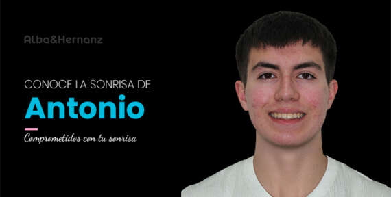 Antonio, 19 años, Brackets metálicos de Autoligado Damon