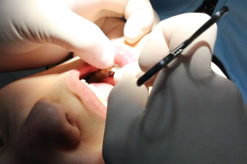 dentista revisando boca infantil