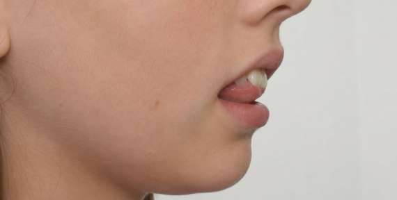 ¿Puede la posición de la lengua mover los dientes?